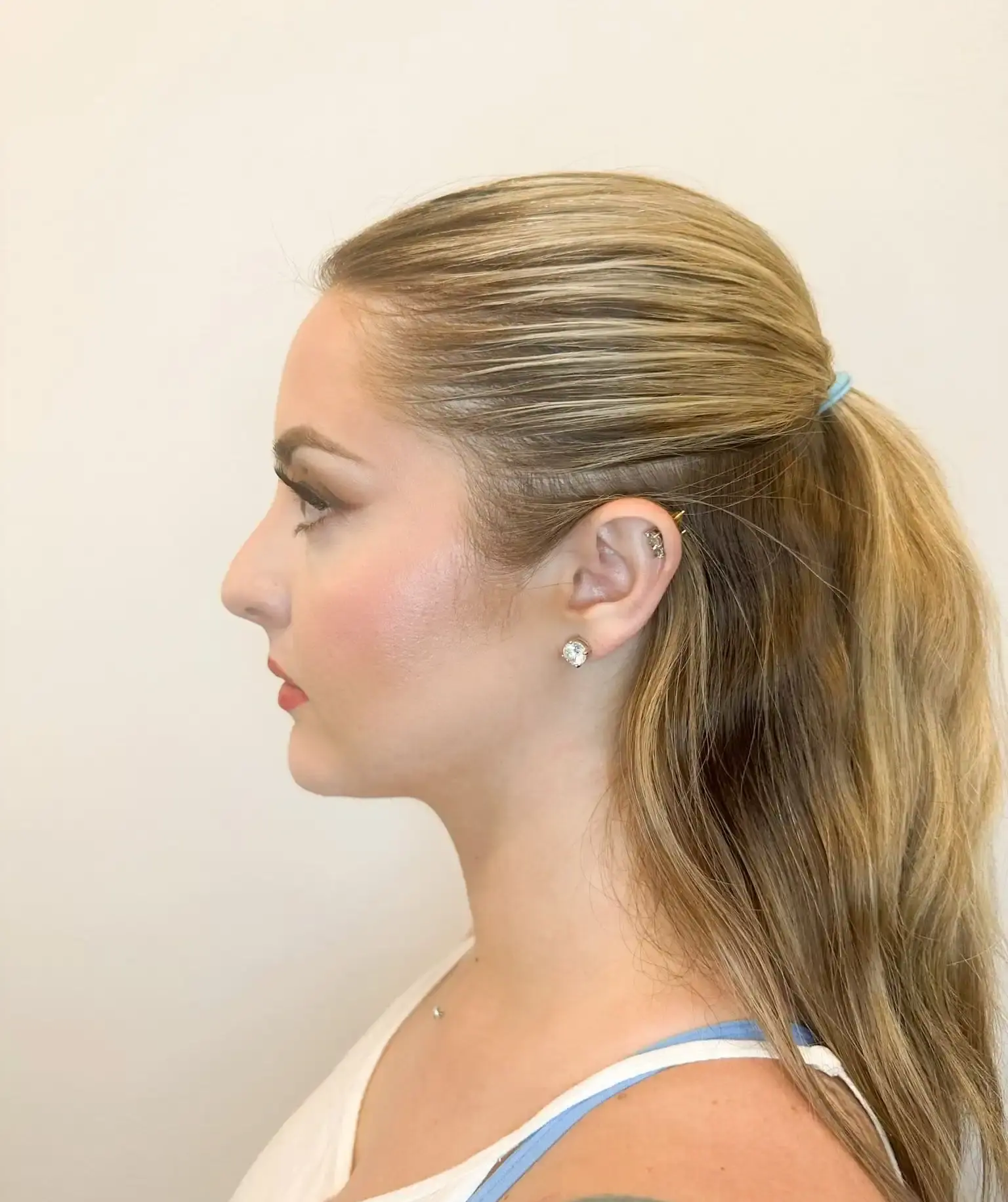 After treatment — client 1