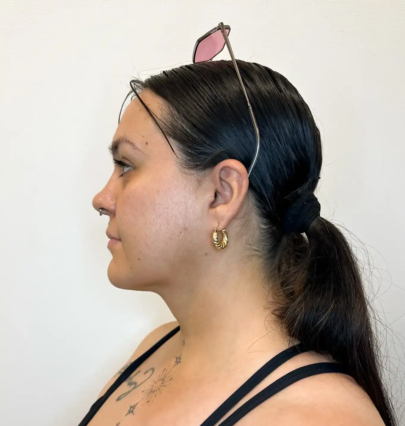 After treatment — client 2
