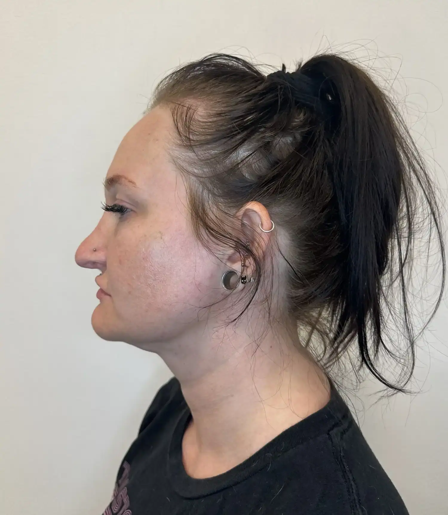 After treatment — client 3
