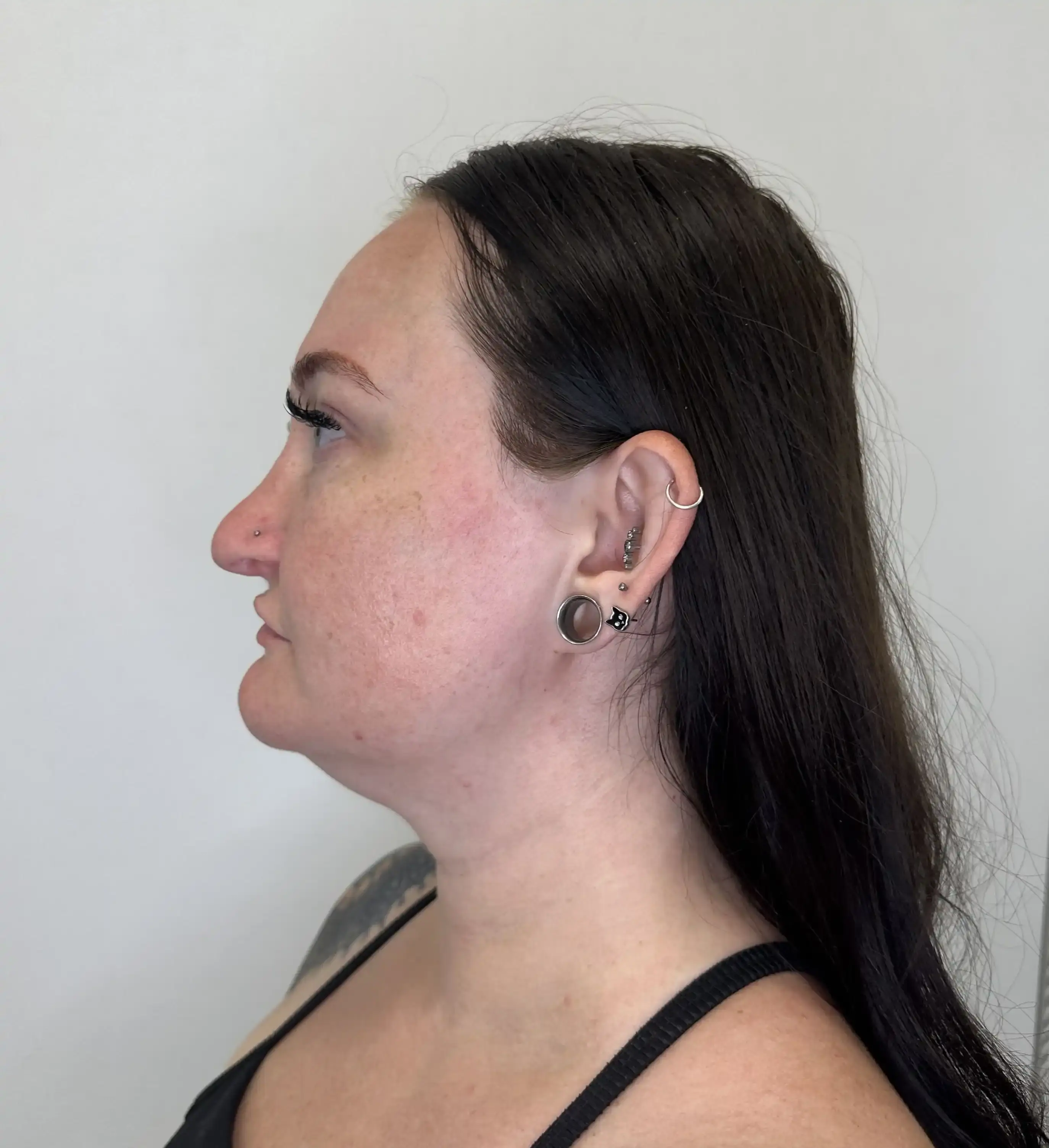 Before treatment — client 3